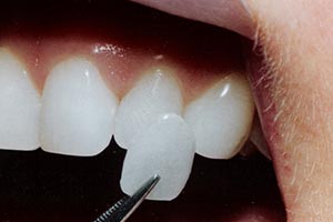 Nicholas Gih DDS: Claremont Dentist - Family and Cosmetic Dentistry — Dentistry clinic in Claremont, CA — photo 3