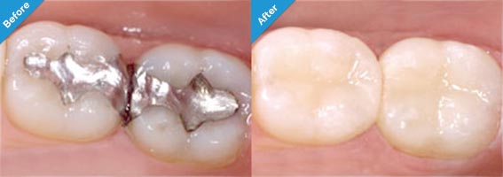 Nicholas Gih DDS: Claremont Dentist - Family and Cosmetic Dentistry — Dentistry clinic in Claremont, CA — photo 8