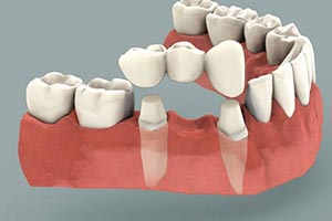 Nicholas Gih DDS: Claremont Dentist - Family and Cosmetic Dentistry — Dentistry clinic in Claremont, CA — photo 6