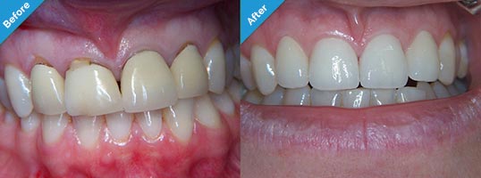 Nicholas Gih DDS: Claremont Dentist - Family and Cosmetic Dentistry — Dentistry clinic in Claremont, CA — photo 7